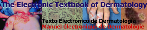 Electronic Textbook of Dermatology 